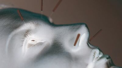 Alternativen Text angeben